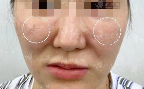 王紹國取生長因子多少錢?價格貴嗎?和郭鑫誰技術更厲害?