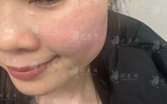 北京黎星醫(yī)生20年專攻修復，生長因子取出微創(chuàng)無痕