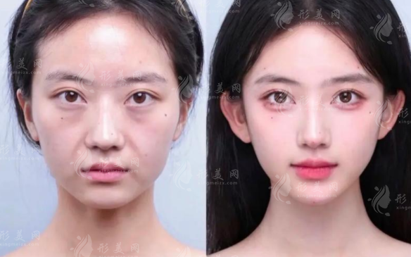 上海幼態(tài)臉醫(yī)生排名2026，郭敬松申濤聶婕技術(shù)解析
