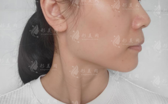 廣州磨骨醫(yī)院哪家好?廣大、韓妃、紫馨資質與專家實力對比