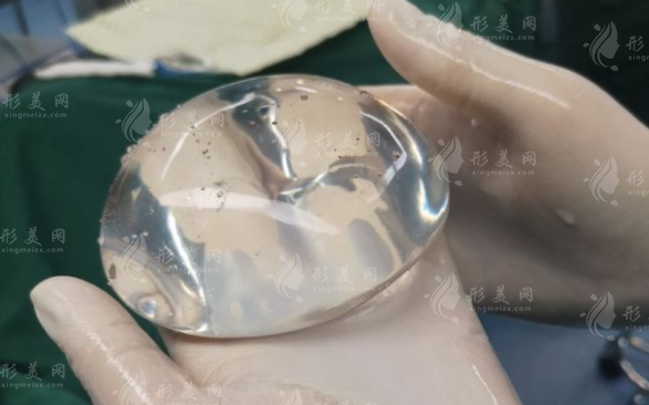 傲諾拉星熠假體型號(hào)全解析：選對(duì)不選貴，這份攻略請(qǐng)收好!