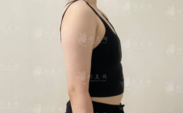 成都隆胸選哪家?后美薛瑞vs美萊熊猛技術(shù)審美大比拼 成都隆胸選哪家?后美薛瑞vs美萊熊猛技術(shù)審美大比拼