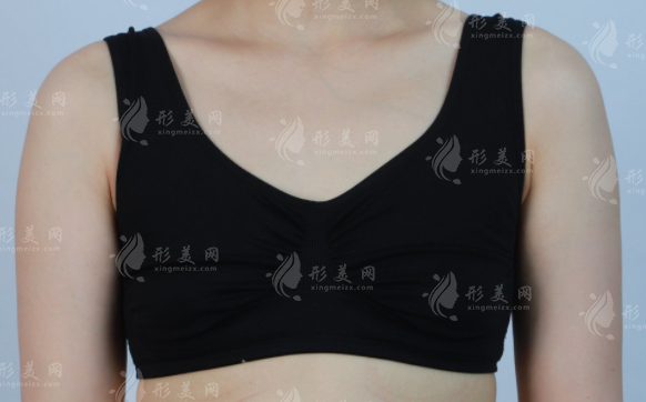國內(nèi)乳房再造醫(yī)院排名前十出爐!附重建技術(shù)名醫(yī)名單