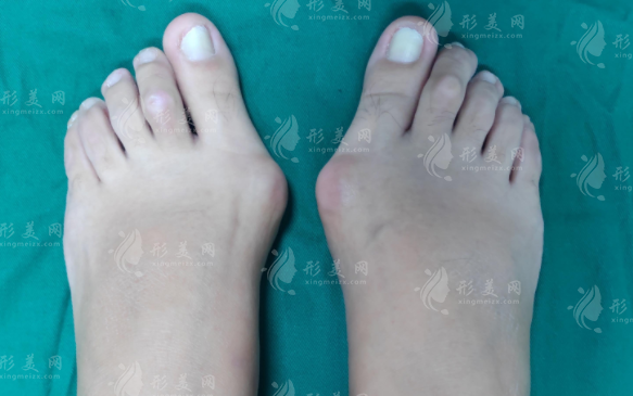 蘇敬達和馬桂文做大腳骨誰更好?技術風格價格全面對比 蘇敬達和馬桂文做大腳骨誰更好?技術風格價格全面對比