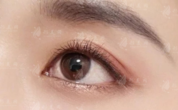 鄭州蔡連朋雙眼皮技術(shù)怎么樣?同樂醫(yī)院坐診自然無痕 鄭州蔡連朋雙眼皮技術(shù)怎么樣?同樂醫(yī)院坐診自然無痕