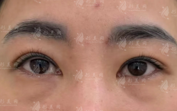 咸陽做眼袋手術(shù)哪家好?三家正規(guī)機(jī)構(gòu)排名推薦