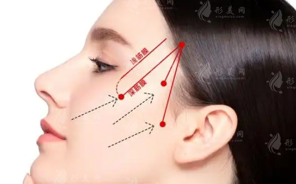 北京筋膜提升醫(yī)院哪家好?6家技術(shù)流醫(yī)院硬核PK
