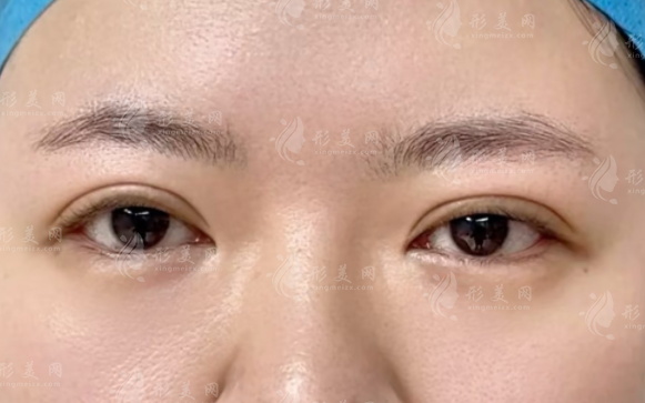 上海眼修復(fù)選羅文婷還是馬娟?技術(shù)對(duì)比全解析
