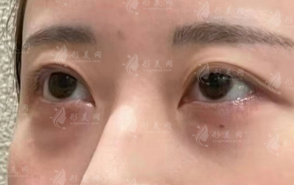 深圳眼修復(fù)醫(yī)生排名前十:經(jīng)驗足/高難度修復(fù)/口碑好閉眼入 深圳眼修復(fù)醫(yī)生排名前十:經(jīng)驗足/高難度修復(fù)/口碑好閉眼入