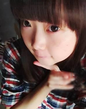 激光去痣 小蘿莉美美噠