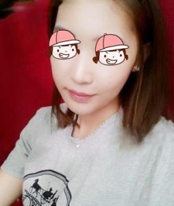 美白針 讓你美四季