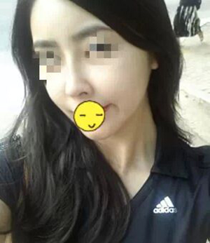 微整形 讓自己變得跟韓劇女主角一樣美膩
