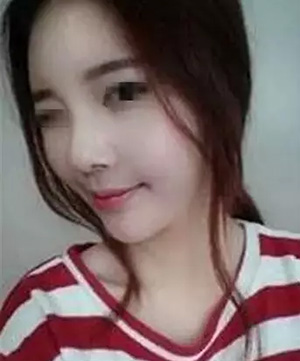 注射額頭鼻子 讓自己五官立體起來了