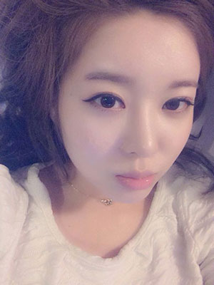 全臉脂肪填充 像韓劇女主一樣甜美