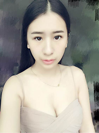 注射下巴+雙眼皮 變成氣質(zhì)美女
