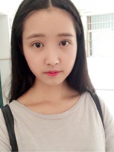 雙眼皮手術(shù) 瞬間變小萌妹