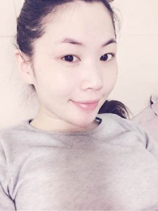 隆鼻+全切雙眼皮 美到無(wú)法呼吸 - 珍美網(wǎng)