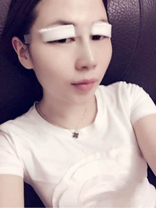 隆鼻+全切雙眼皮 美到無(wú)法呼吸 - 珍美網(wǎng)