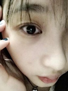 雙眼皮手術(shù) 讓自己更加甜美可愛(ài) - 珍美網(wǎng)