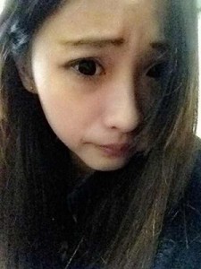 雙眼皮手術(shù) 讓自己更加甜美可愛(ài) - 珍美網(wǎng)