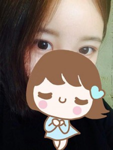 雙眼皮手術(shù)+開眼角 讓自己更加女人