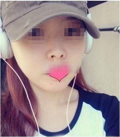 面部整形 讓男友更愛自己