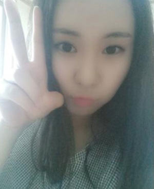 面部吸脂 變v字臉不是問題