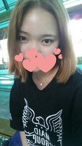 雙眼皮手術(shù) 魅力無(wú)限大 - 珍美網(wǎng)