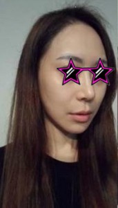 面部整形 實現(xiàn)變成女神愿望 - 珍美網