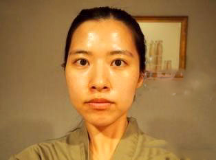 面部自體脂肪填充 還原最美的自己 - 珍美網(wǎng)
