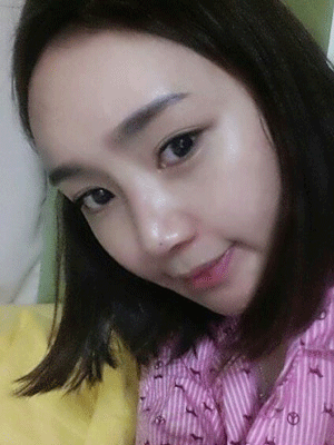面部整形 逆襲成氣質美女 - 珍美網(wǎng)