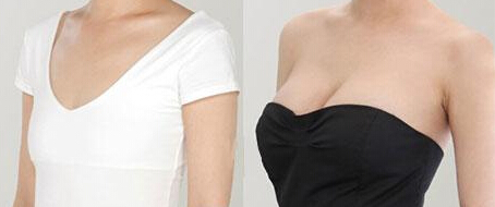 李達(dá)乳房再造術(shù)多少錢 - 珍美網(wǎng)