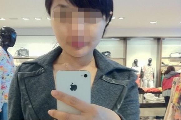 下頜角手術(shù) 實(shí)現(xiàn)甜美清新小臉