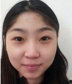 面部整形 做個(gè)精致完美的女人 - 珍美網(wǎng)