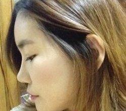 地包天矯正術(shù) 實現(xiàn)活潑美麗的自己 - 珍美網(wǎng)