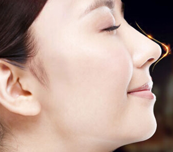 隆鼻不僅僅是膠體植入 總有一款類型適合你 - 珍美網(wǎng)