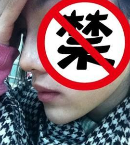 玻尿酸隆鼻+墊下巴 提升面部氣質(zhì)