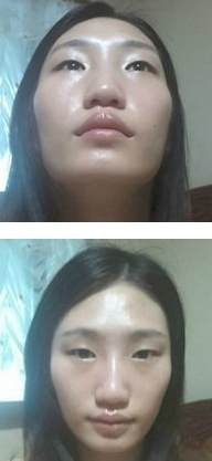 磨顴骨  實(shí)現(xiàn)美的自己讓男朋友越來(lái)越愛(ài) - 珍美網(wǎng)