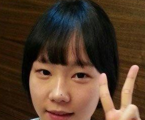 眼部整形 讓自己更加美麗動人 - 珍美網(wǎng)