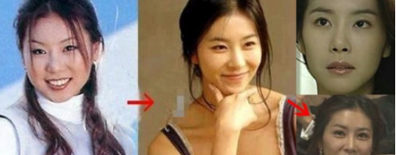 80%以上韓星都有整形史 會不會也想要變美呢？ - 珍美網(wǎng)