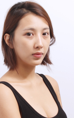 面部脂肪移植 實(shí)現(xiàn)跟女明星一樣的美麗 - 珍美網(wǎng)