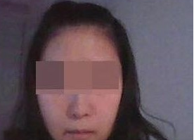 吸脂瘦臉 讓五官更加立體精致