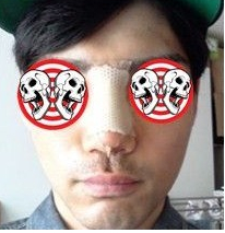 面部整形 變男神也是分分鐘的事 - 珍美網(wǎng)