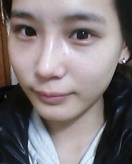 隆鼻手術(shù) 讓我更加充滿(mǎn)信心 - 珍美網(wǎng)