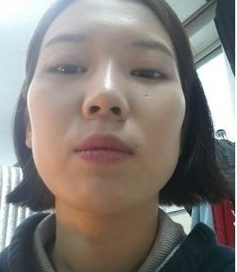 磨顴骨 才發(fā)現(xiàn)原來我可以這么美 - 珍美網(wǎng)