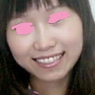 注射瘦臉針  我也可以美美噠 - 珍美網(wǎng)