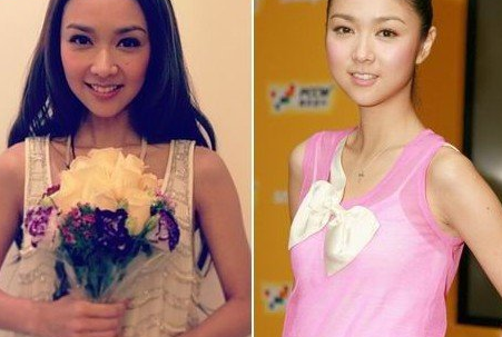 女神薛凱琪整容手術(shù) 對(duì)比照差距大 - 珍美網(wǎng)