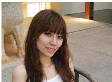 面部吸脂  比之前更加甜美漂亮啦 - 珍美網(wǎng)