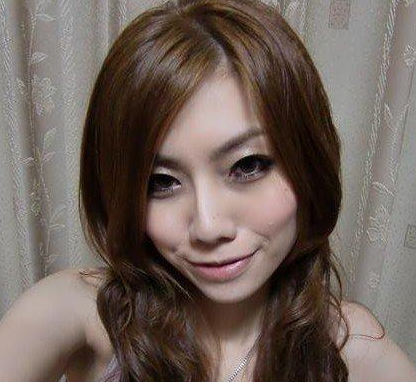 面部吸脂  比之前更加甜美漂亮啦 - 珍美網(wǎng)