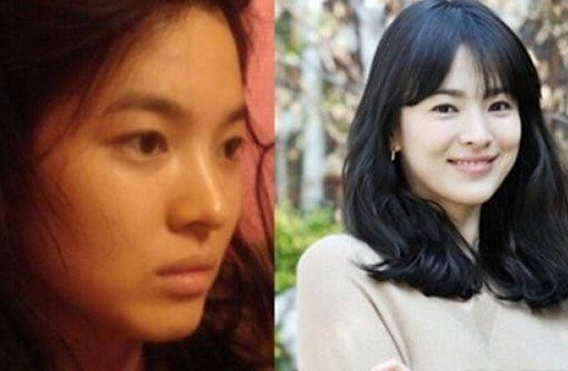 公認(rèn)的零整容女星 有你們的女神嗎 - 珍美網(wǎng)